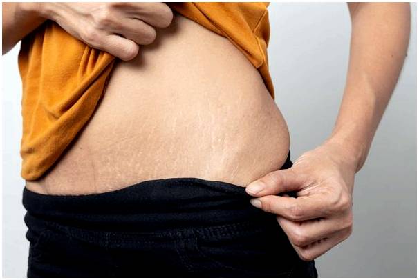 10 ключей к уходу за кожей после родов