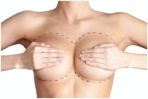 Совместимы ли грудные и грудные имплантаты?
