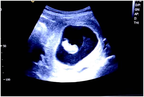 9 неделя беременности: симптомы, развитие ребенка и рекомендации