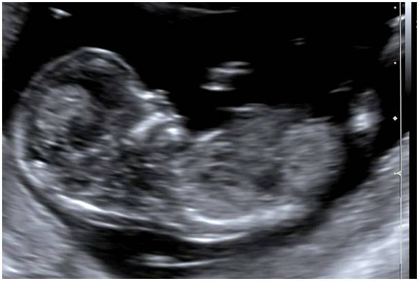 12 неделя беременности: симптомы, развитие ребенка и рекомендации