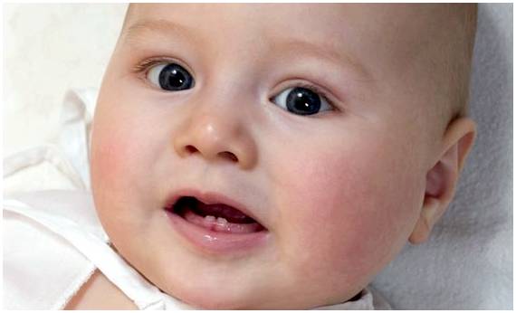 Возможные осложнения прорезывания зубов у малышей