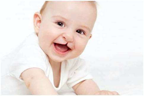 Черепно-лицевые пороки развития у младенцев