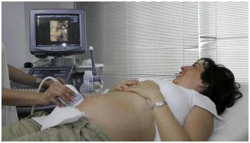 Что беременным женщинам следует знать о вирусе Зика