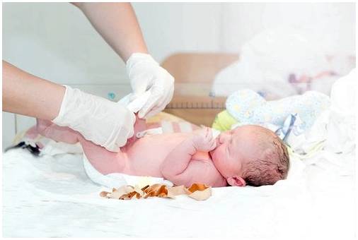 Как вылечить пуповину малыша после родов?
