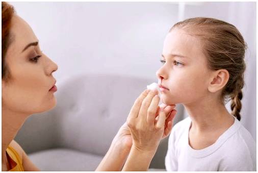 У моего ребенка сильное кровотечение из носа, что мне делать?
