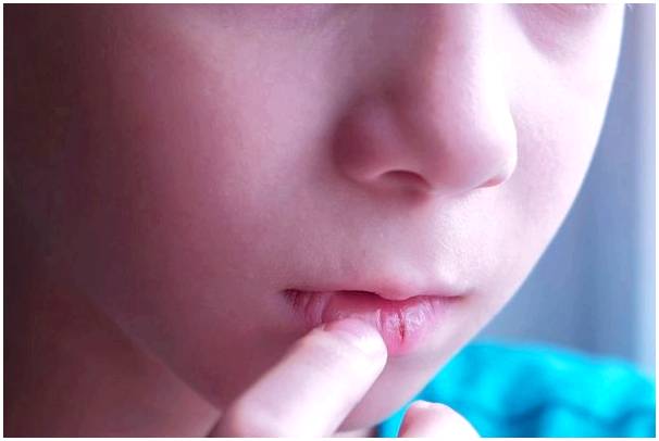 Почему у детей сохнут губы?